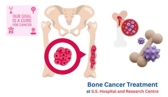 Bone Cancer Treatment